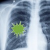 Pneumonia Guide app logo image