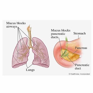 Cystic Fibrosis app logo image