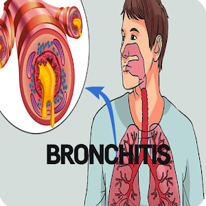 Bronchitis Infection app logo image